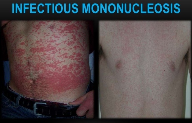 skin rash pictures diagnosis #11