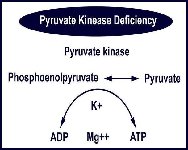 Pyruvate Kinase Deficiency