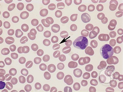 Stomatocytes
