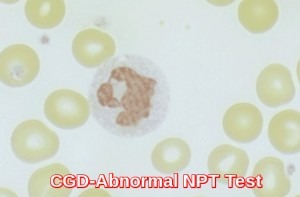 CGD-Abnormal NBT Test