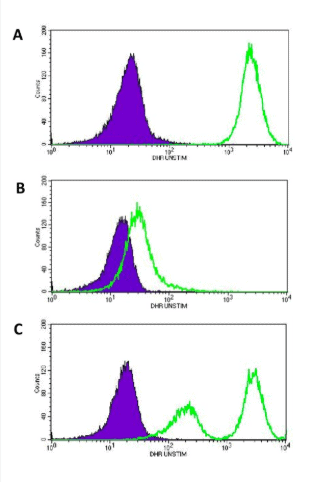 DHR flow cytometry showing normal oxidative burst, CGD carrier mosaic pattern, and absent oxidative burst in Chronic Granulomatous Disease