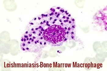 Leishmaniasis-Bone Marrow Macrophage