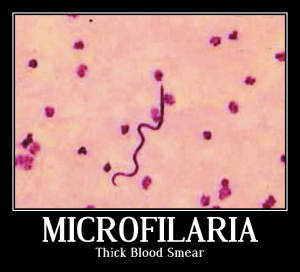 Microfilaria