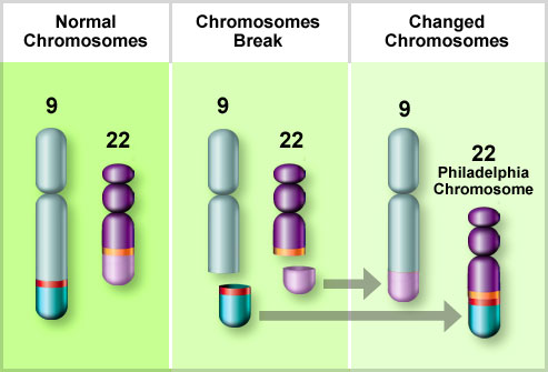 Chronic Myeloid Leukemia