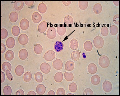 Plasmodium Malariae Schizont