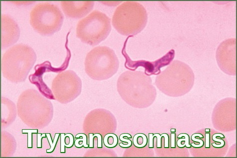 Trypanosomiasis