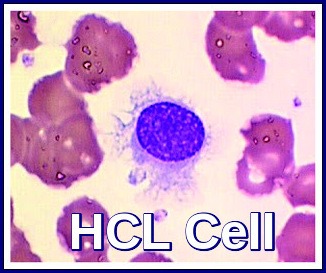 Hairy Cell Leukemia Cell
