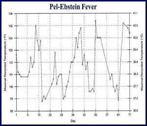 Pel-Ebstein Fever