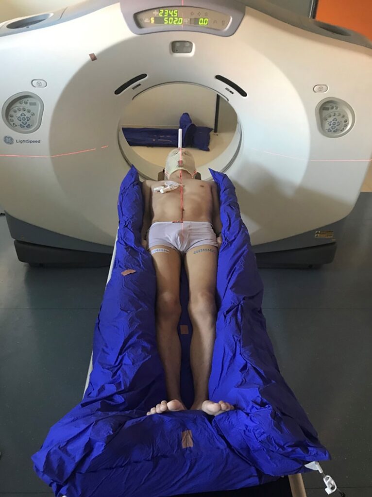 Stem Cell Transplantation