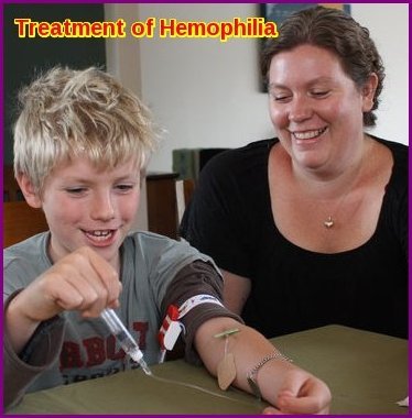 Hemophilia Treatment