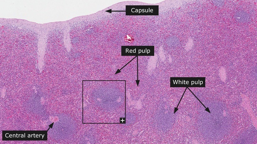 normal and enlarged spleen