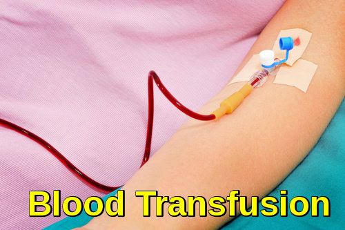 Administering Red Blood Cells via Intravenous Line A photograph illustrating the blood transfusion procedure