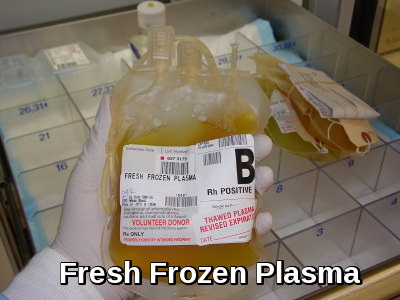Unit of Fresh Frozen Plasma (FFP) for Transfusion