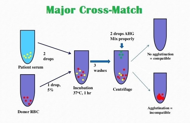 Procedure for Major Crossmatch Blood Compatibility Test