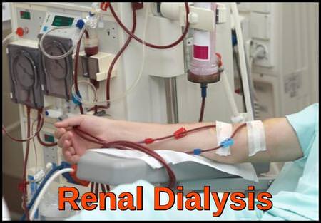 Patient undergoing hemodialysis for acute kidney injury and electrolyte imbalance