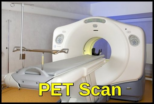 PET CT Scan