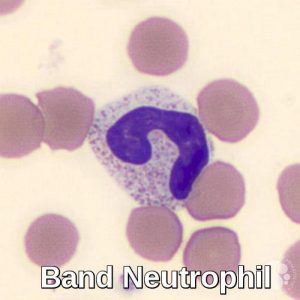 Blood Morphology - Ask Hematologist