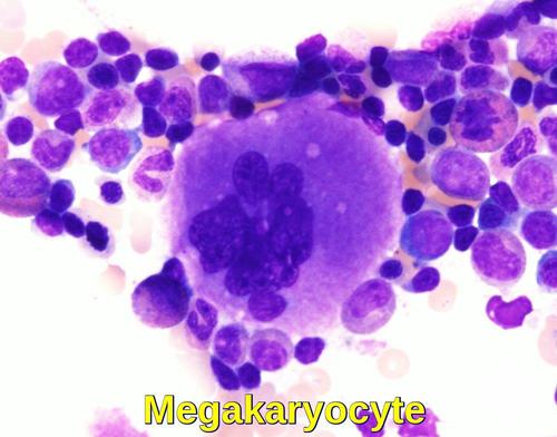 Erythrocyte Inclusions | Treatment & Management | Point of Care