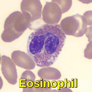 Eosinophil