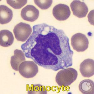 Monocyte Image
