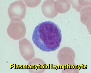 atypical lymphocyte