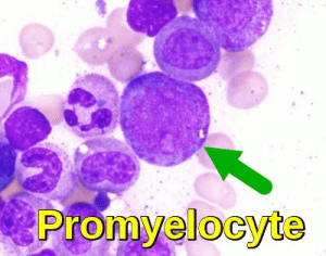 Promyelocyte