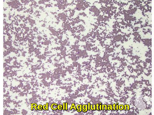 Red Cell Agglutination