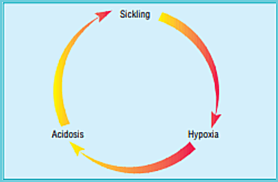 Sickle Cell Crisis