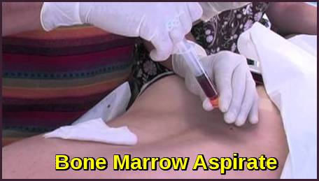 Bone Marrow Examination