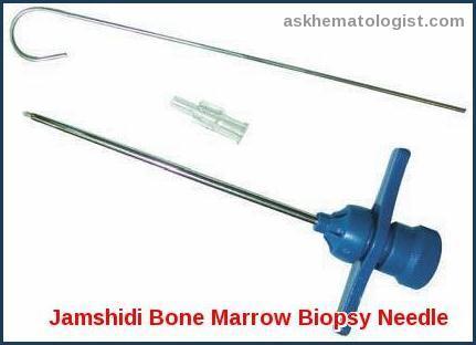 Bone Marrow Examination