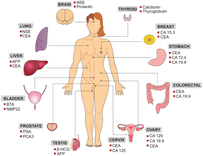 Tumor Markers by Organ System – CEA, CA 125, PSA, AFP Overview Tumor markers diagram showing organ-specific cancer biomarkers including CEA, CA 125, PSA, AFP, CA 19-9, CA 15-3, calcitonin and NSE