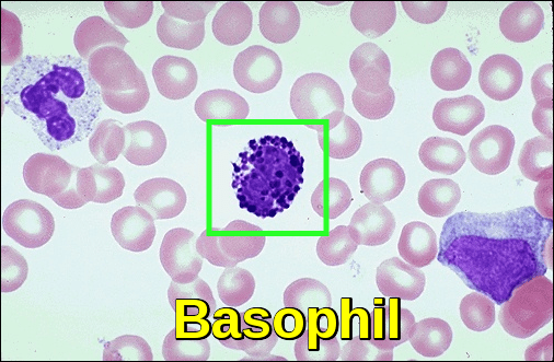 Blood smear - basophil