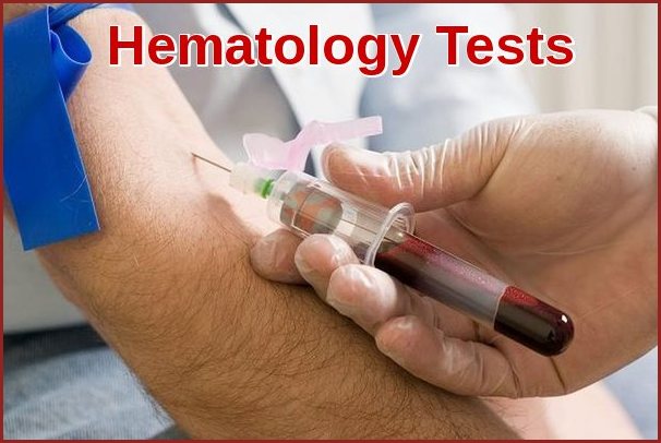 Common Hematology Tests