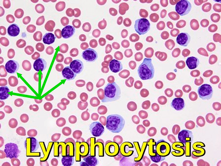 Small Lymphocytes