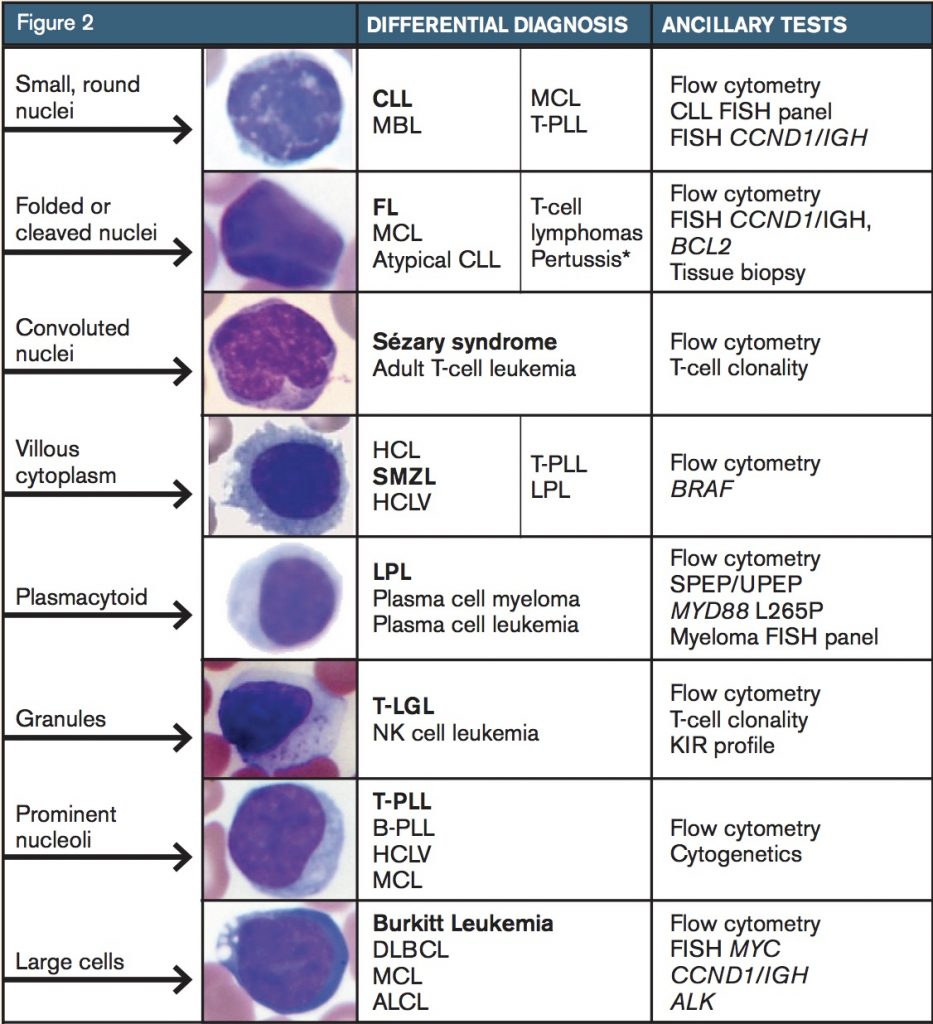 reactive lymphocytes vs monocytes