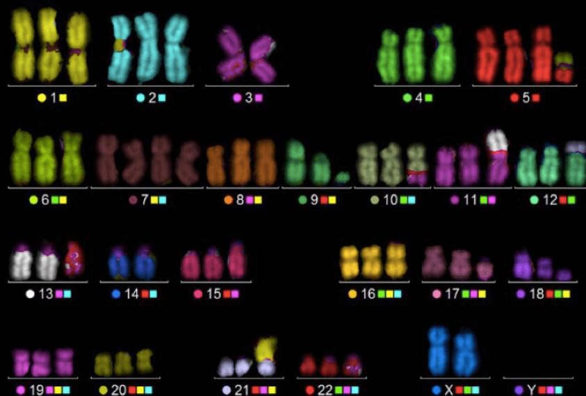 M-FISH karyotype showing multicolor chromosome analysis Multicolor FISH karyotype displaying uniquely colored chromosomes for detecting cryptic rearrangements in molecular and cytogenetic studies in hematology.