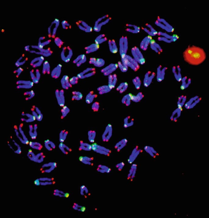 Telomere and centromere FISH staining – molecular and cytogenetic studies in hematology Telomere and centromere FISH staining showing fluorescent chromosome ends in molecular and cytogenetic studies in hematology.