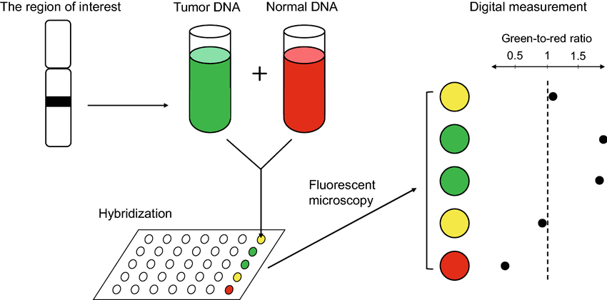 aCGH workflow – Molecular and Cytogenetic Studies in Hematology aCGH workflow comparing tumor and normal DNA to detect copy-number abnormalities in molecular and cytogenetic studies in hematology.